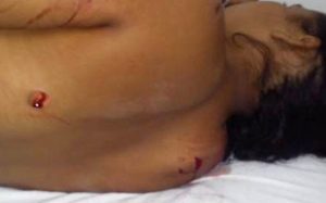 “Están perforados sus pulmones”, dice el hermano de la mujer apuñalada 12 veces por su concubino